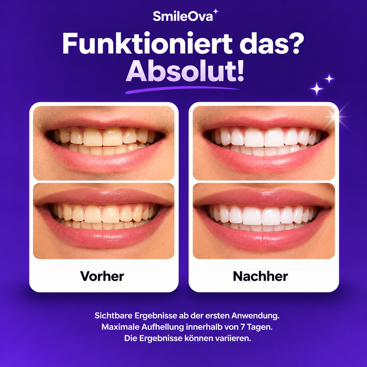 SmileOva™ Purple Whitening Strips
